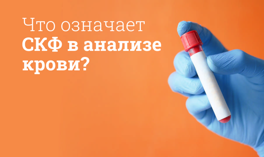 Что значит рассчитать СКФ?
