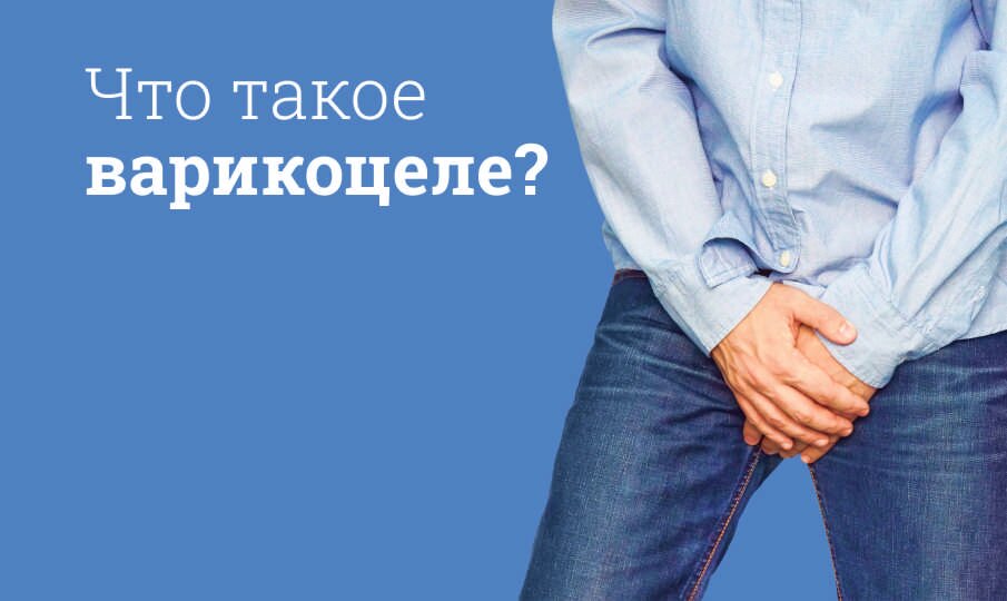 Варикоцеле: симптомы и лечение