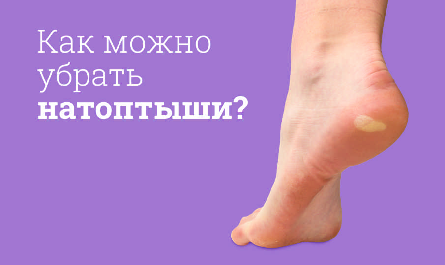 Лечение натоптышей