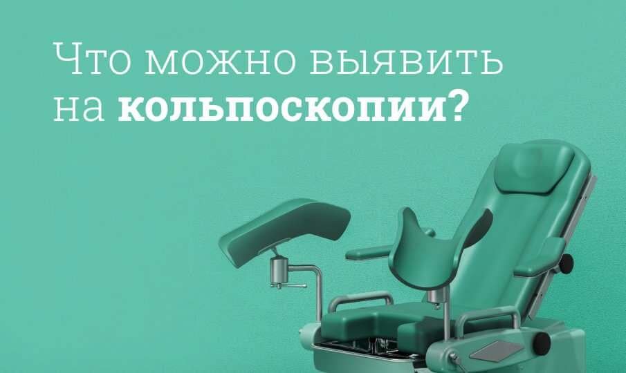 Кольпоскопия шейки матки