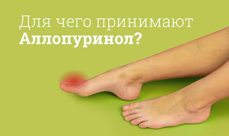 Аллопуринол инструкция по применению