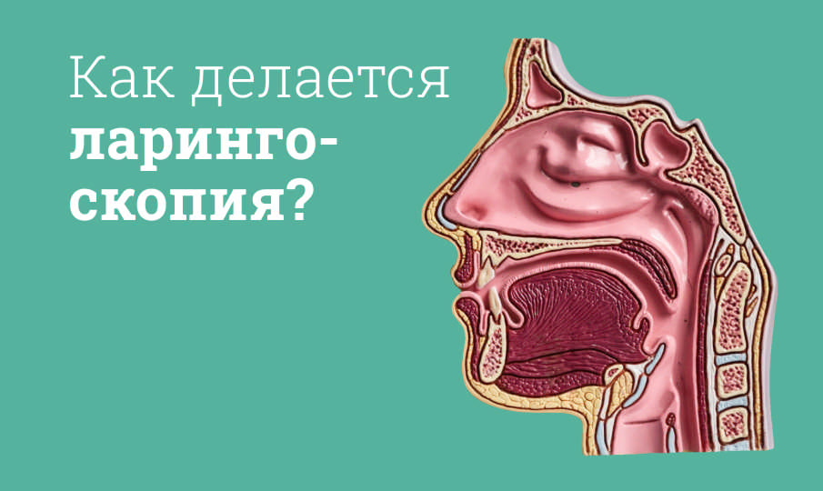 Что такое ларингоскопия?