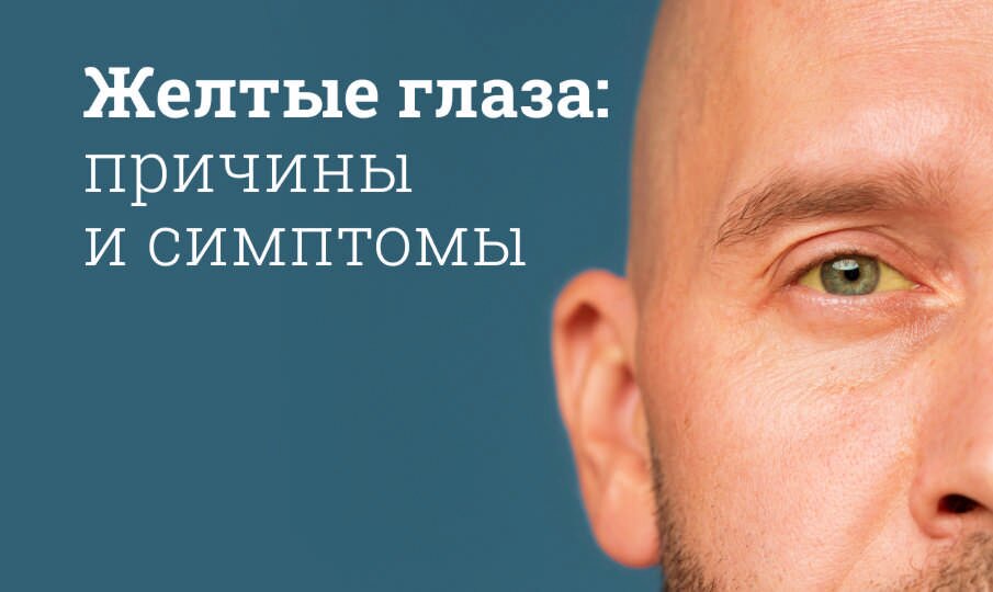 Желтые белки глаз