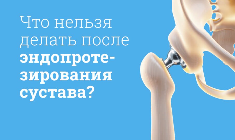 Что нельзя делать после эндопротезирования сустава?