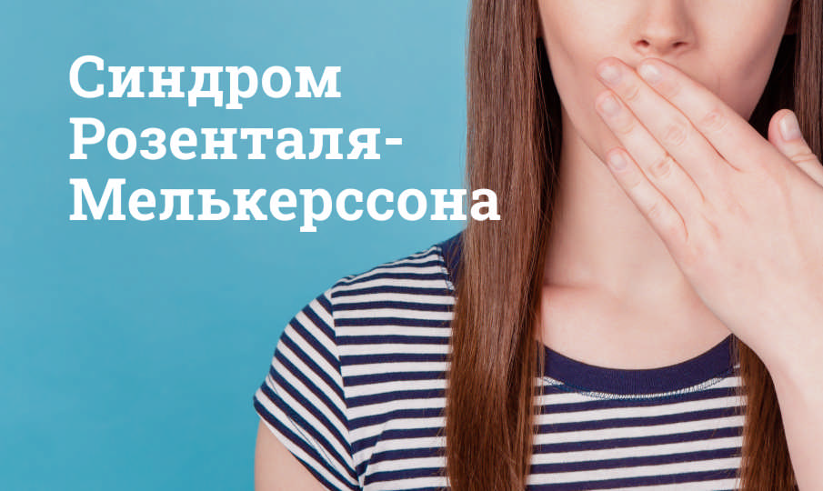 Синдром Розенталя-Мелькерссона