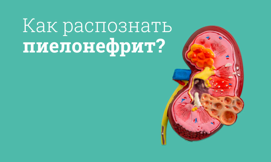 Симптомы и лечение пиелонефрита