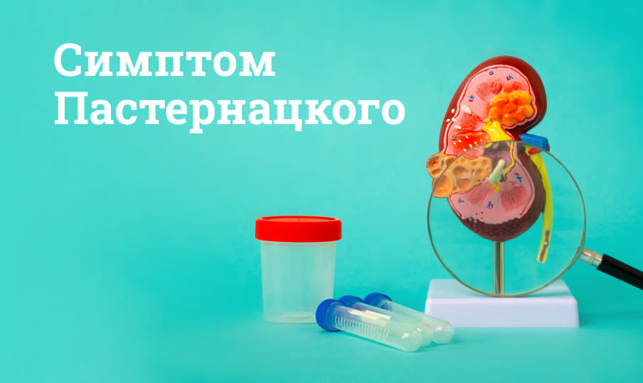 Симптом Пастернацкого