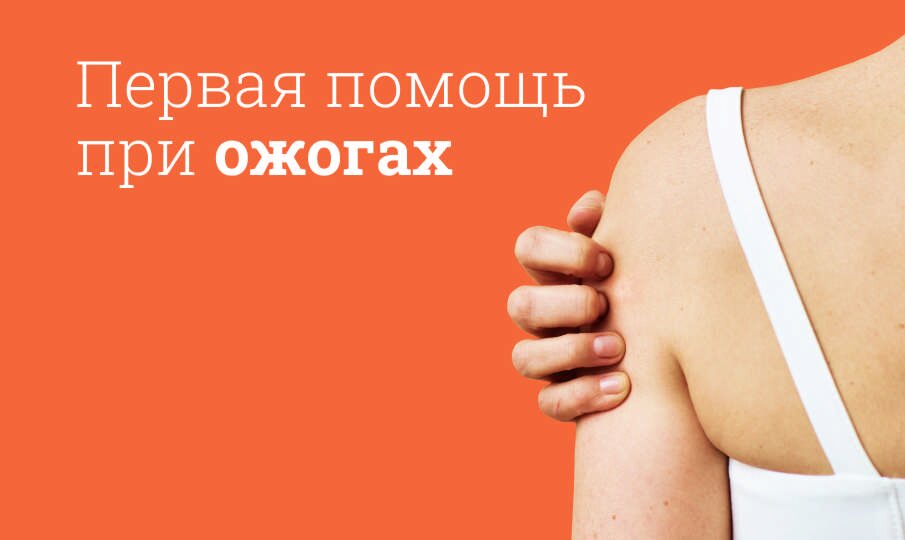 Первая помощь при ожогах