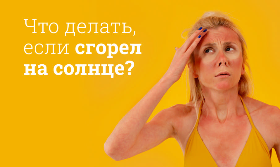 Что сделать, если сгорел на солнце?