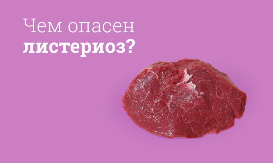 Листериоз: симптомы и лечение