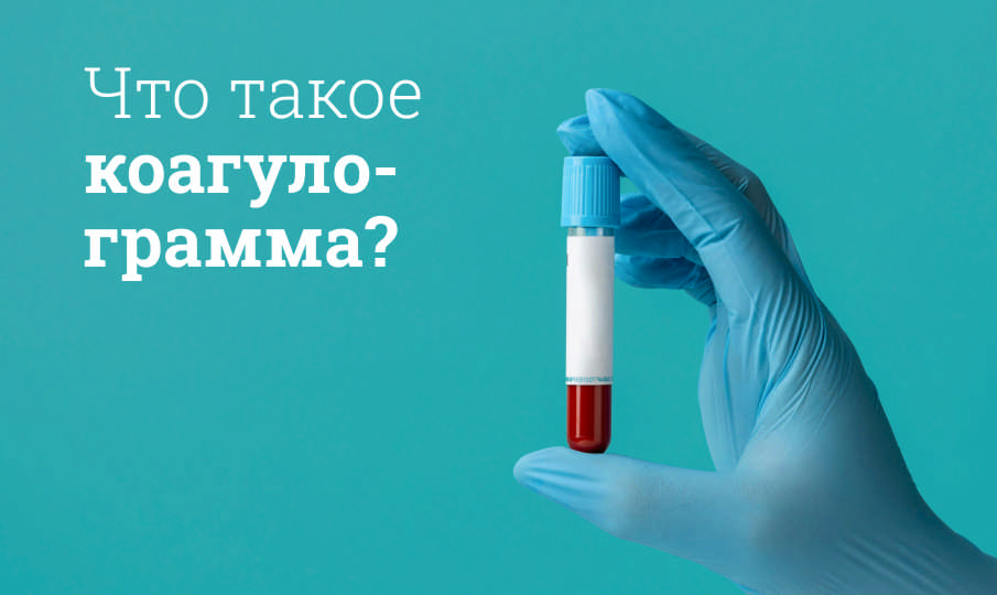 Что это за анализ коагулограмма?