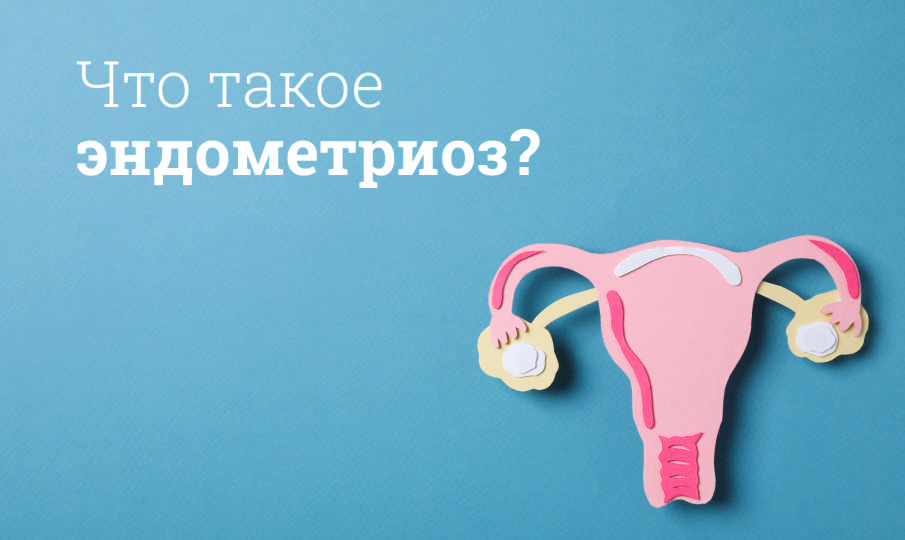 Что такое эндометриоз?