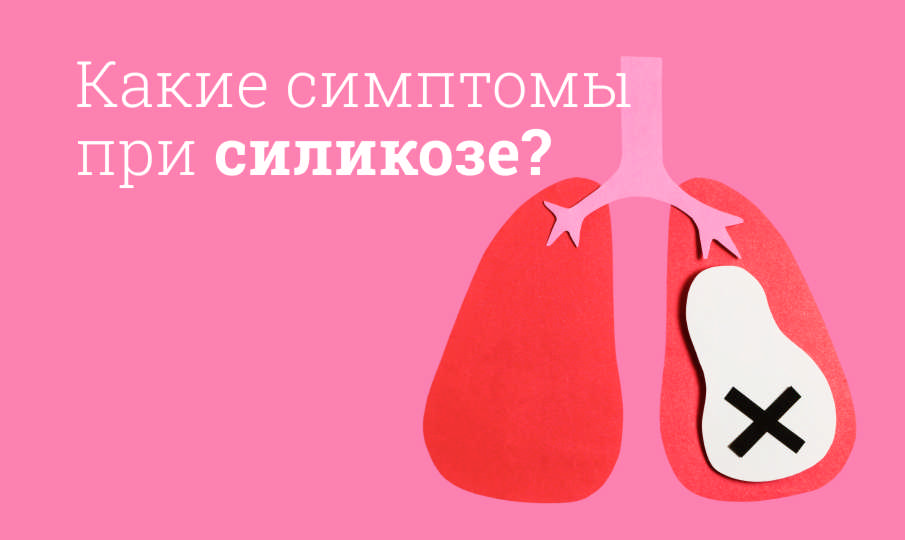 Что такое силикоз?