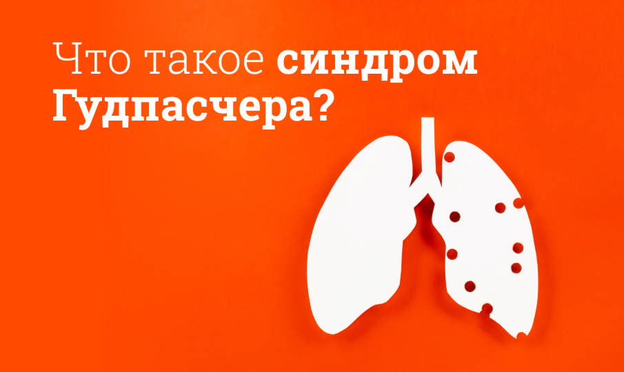 Синдром Гудпасчера