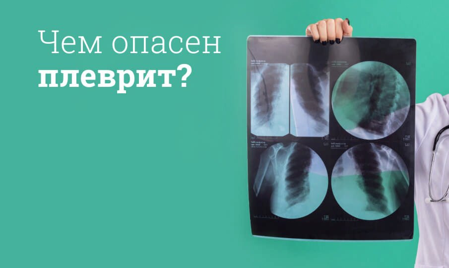 Плеврит легких: симптомы и лечение