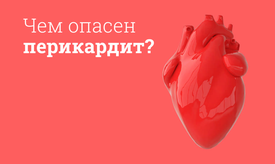 Лечение перикардита