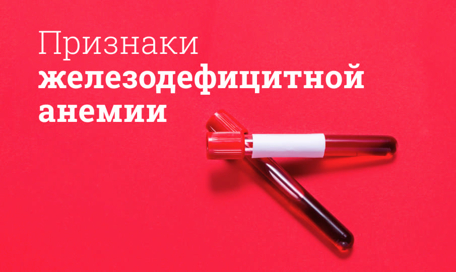 Железодефицитная анемия: причины, симптомы, лечение