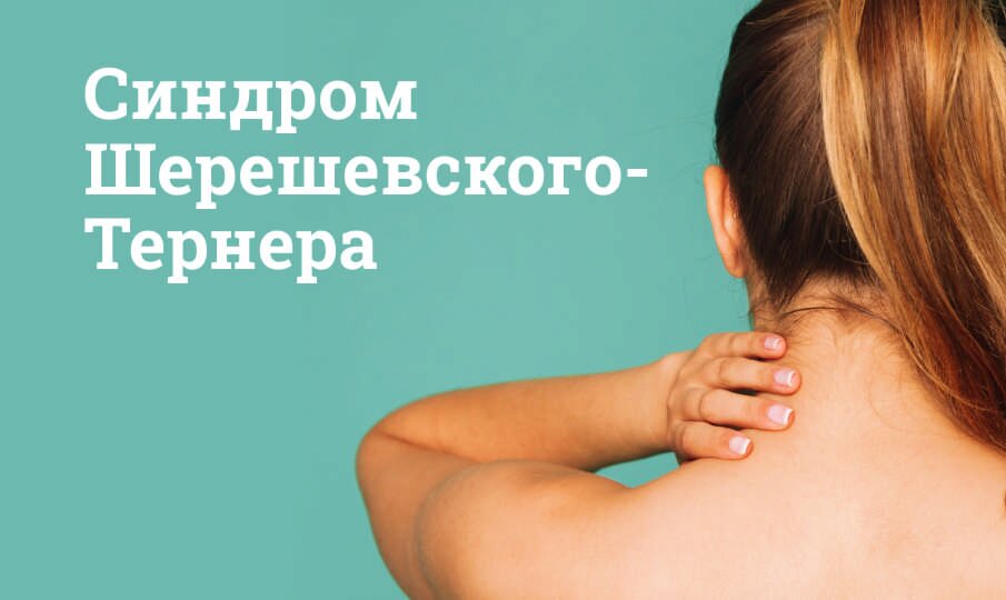 Синдром Шерешевского-Тернера