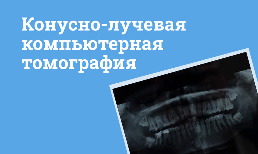 Что такое КЛКТ?