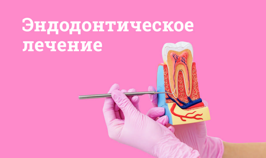 Эндодонтическое лечение