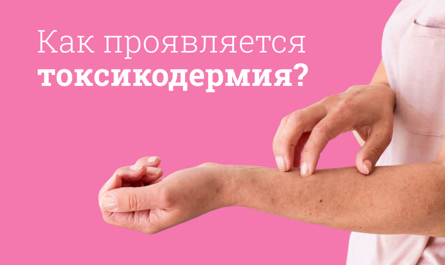 Что такое токсикодермия?