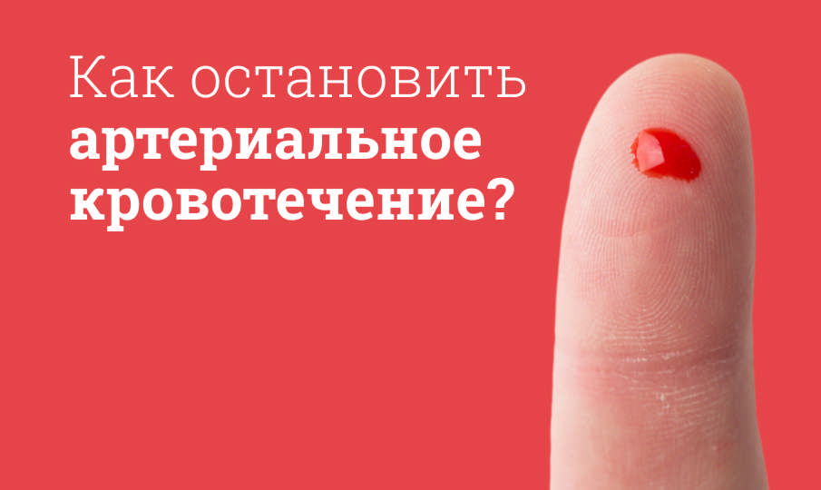 Быстрый способ остановки артериального кровотечения