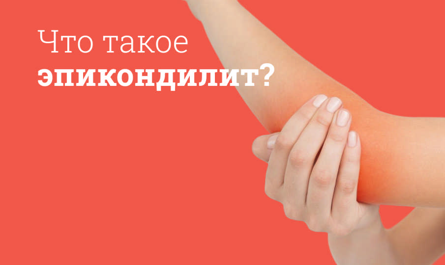 Лечение эпикондилита