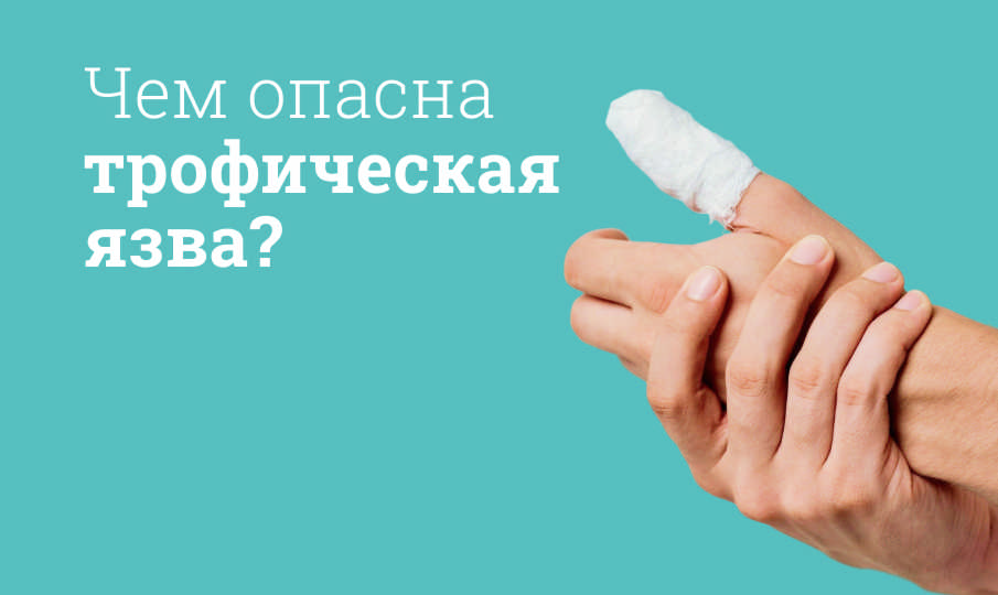 Лечение трофических язв