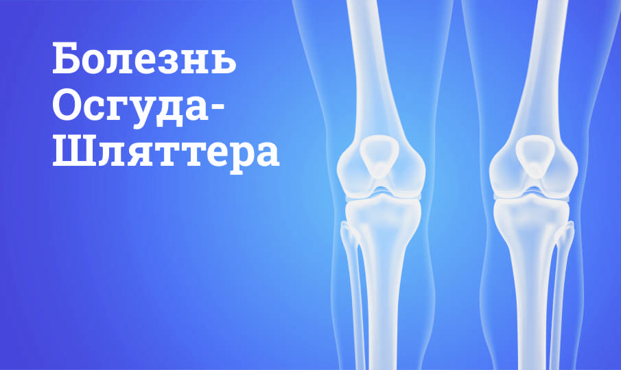 Болезнь Осгуда-Шляттера