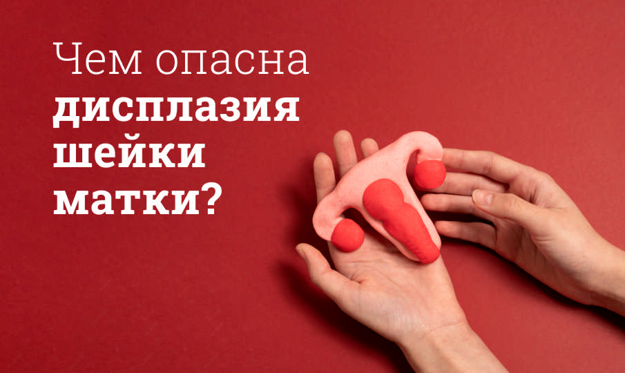Дисплазия шейки матки