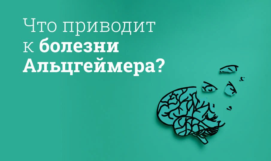 Симптомы и лечение болезни Альцгеймера