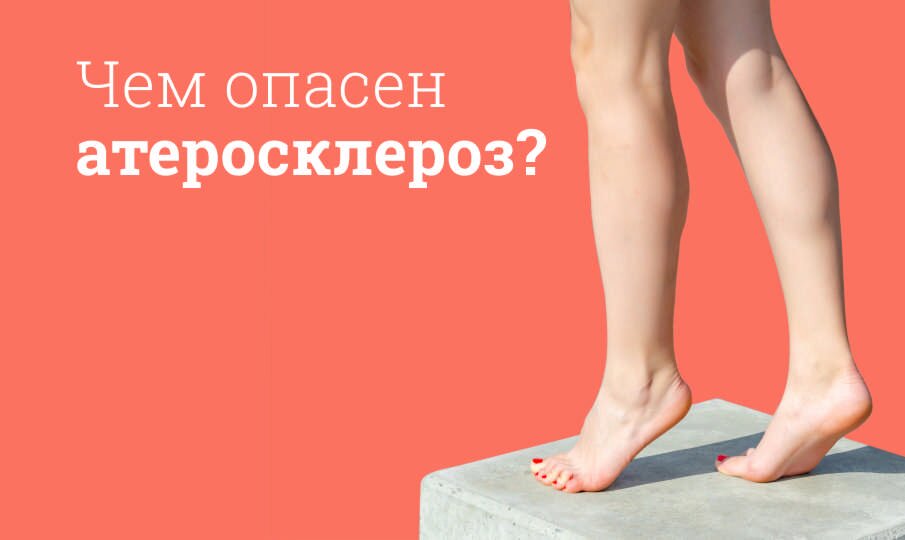 Атеросклероз: лечение и симптомы