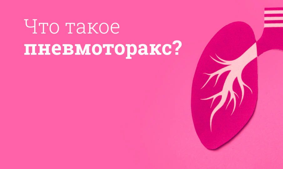 Пневмоторакс симптомы и лечение, виды: Спонтанный, Напряженный ...