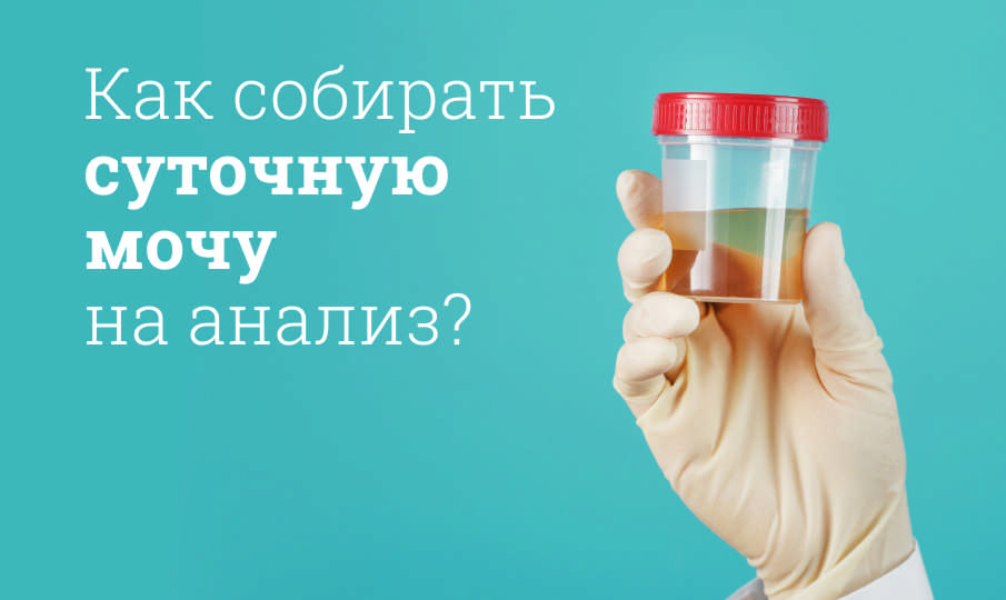 Как собирать суточную мочу на анализ?