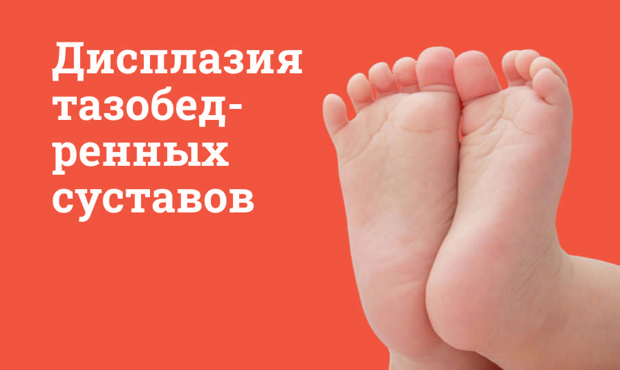 Дисплазия тазобедренных суставов
