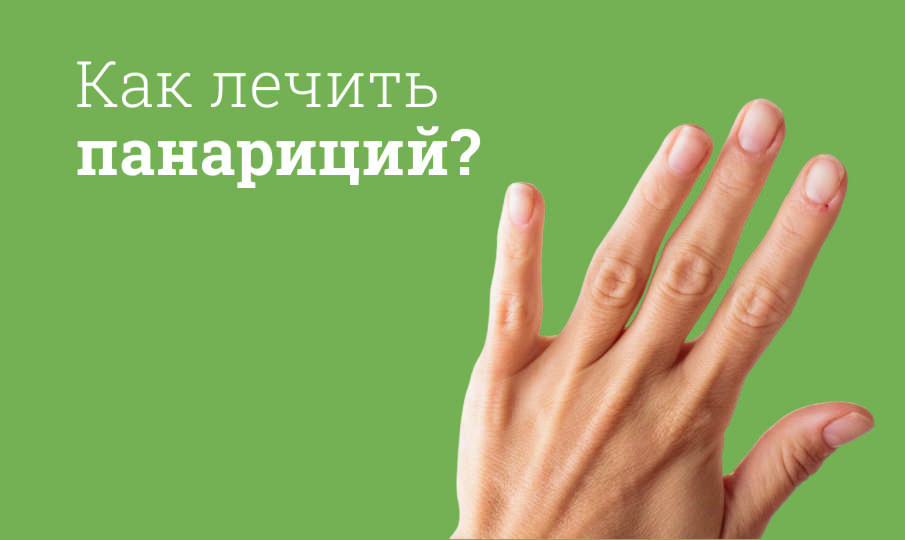 Как лечить панариций?