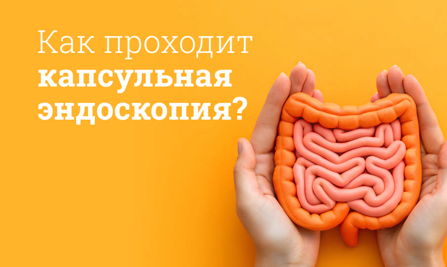 Капсульная эндоскопия