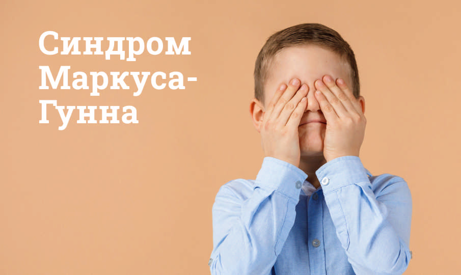 Синдром Маркуса-Гунна