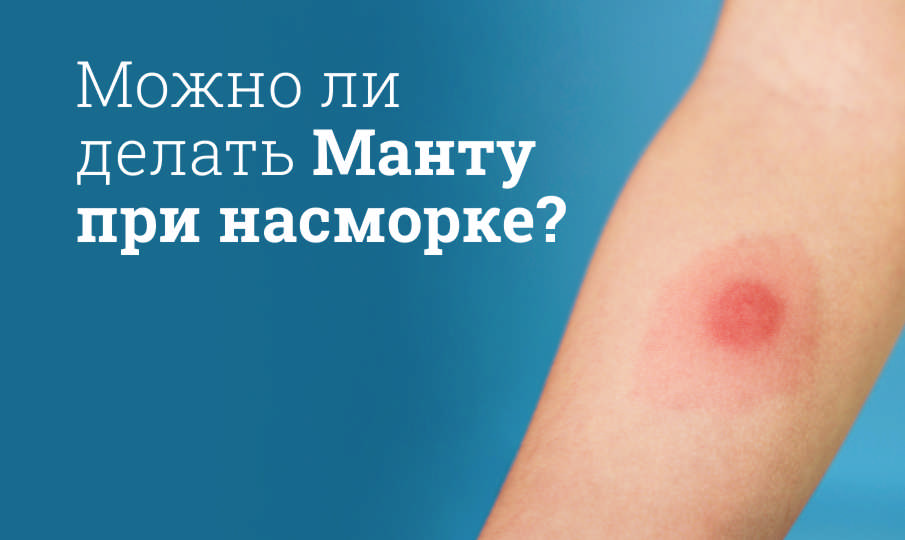 Можно ли делать Манту при насморке?