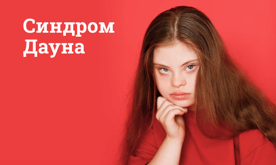 Синдром Дауна