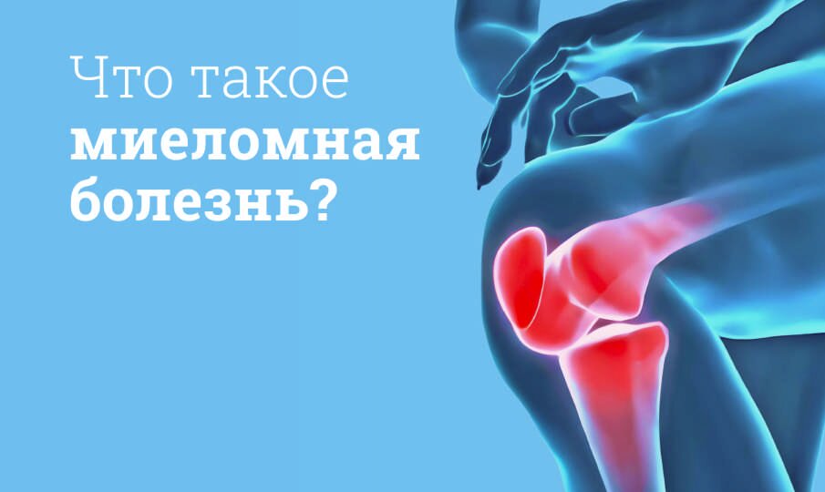 Что такое миеломная болезнь?
