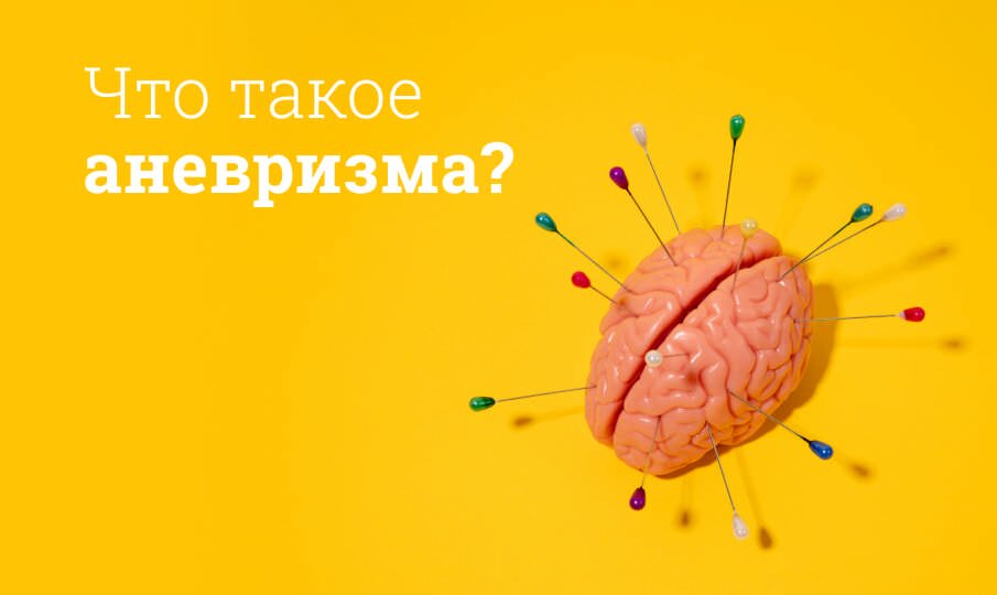 Что такое аневризма?