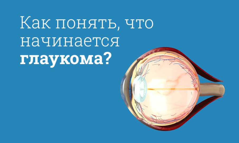 Как понять, что начинается глаукома?