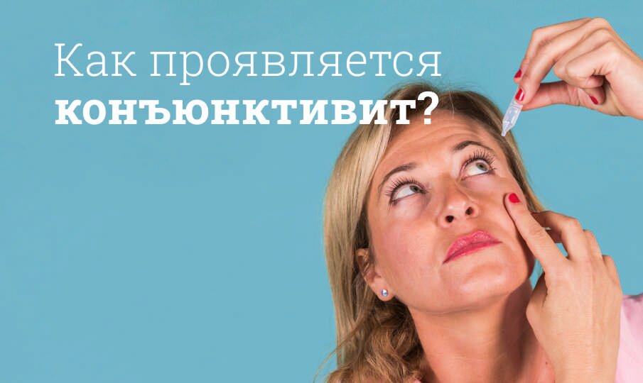 Конъюнктивит: клинические рекомендации