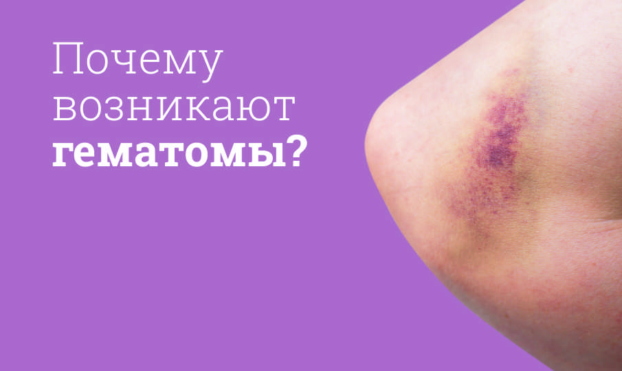 Лечение гематомы