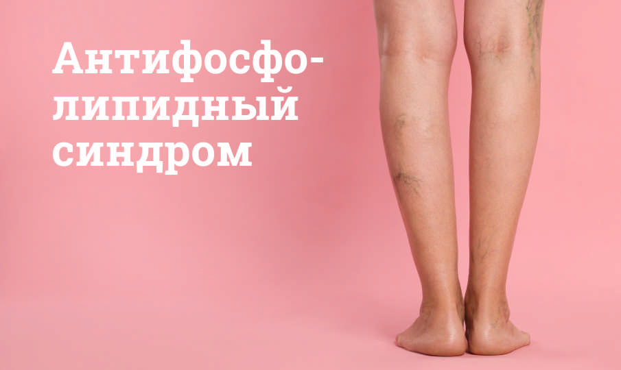 Антифосфолипидный синдром