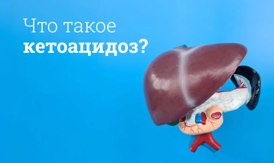 Лечение кетоацидоза