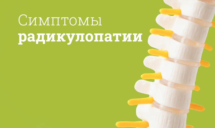 Радикулопатия: симптомы и лечение