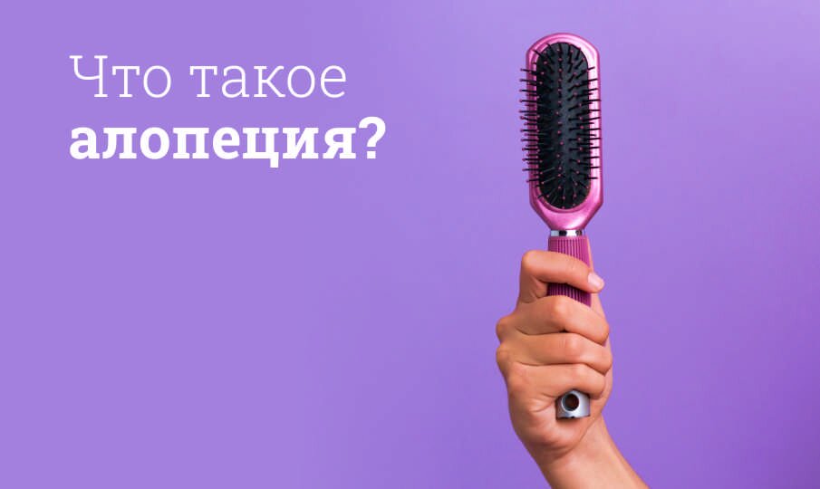 Лечение алопеции