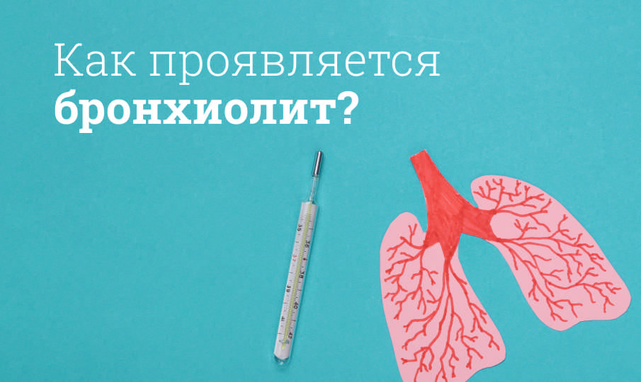 Лечение бронхиолита